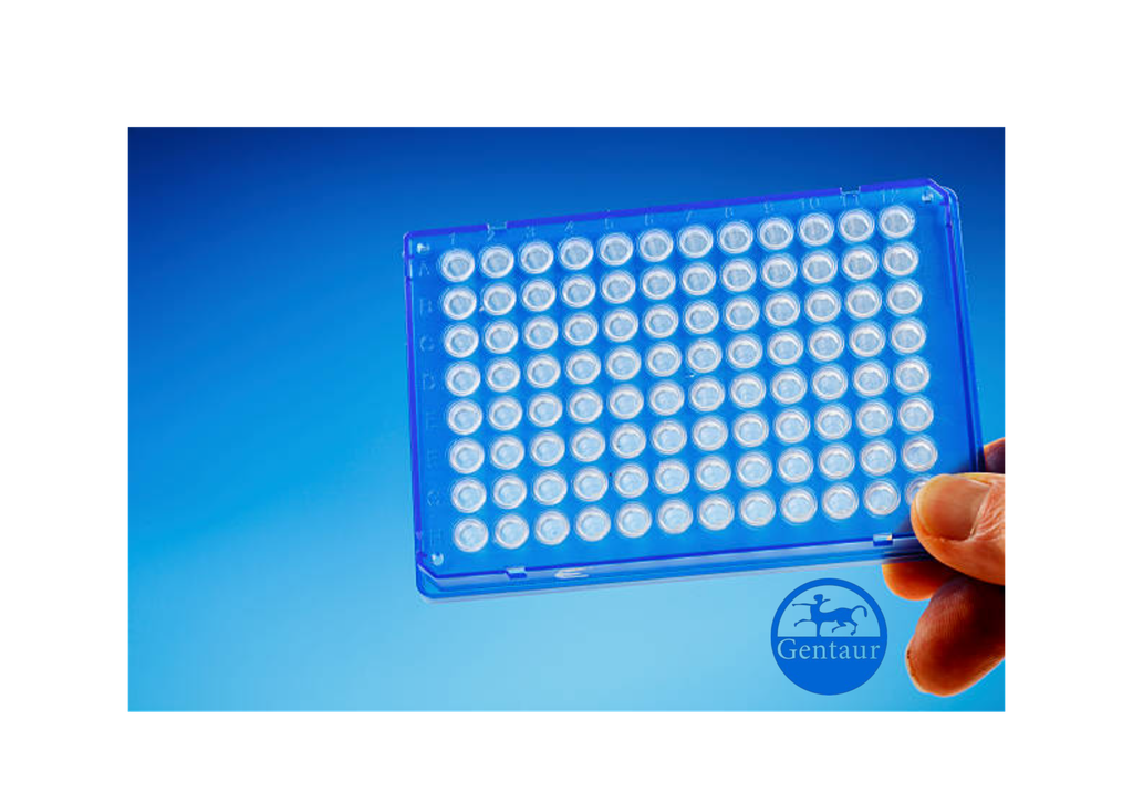 ELISA  Acetyl-Histone H2B (K15) anti-