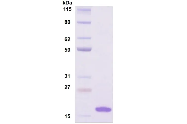 [MC09-100] Recombinant Human Siglec-7, His Tag -100 ug