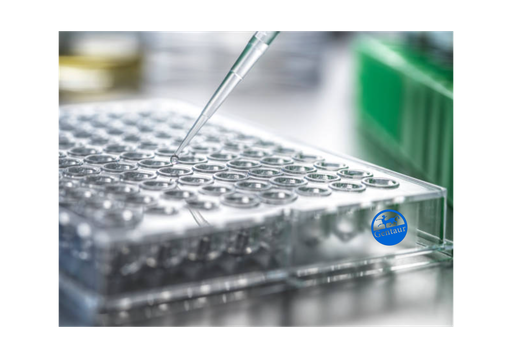 [CSB-PA001871ESR1HU] ELISA  AP2B1 anti-